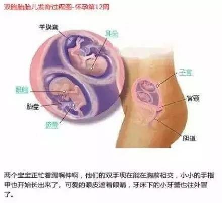 雙胞胎在媽媽肚子里時原來是這樣的 看完圖全懂了