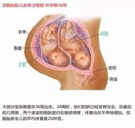 雙胞胎在媽媽肚子里時原來是這樣的 看完圖全懂了