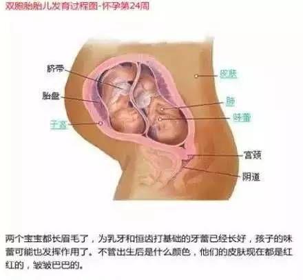 雙胞胎在媽媽肚子里時原來是這樣的 看完圖全懂了
