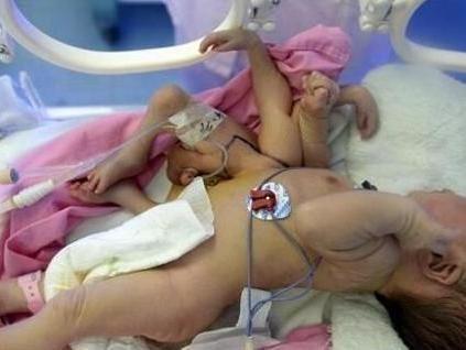 婆婆迷信中醫不做B超 最後卻釀成大禍