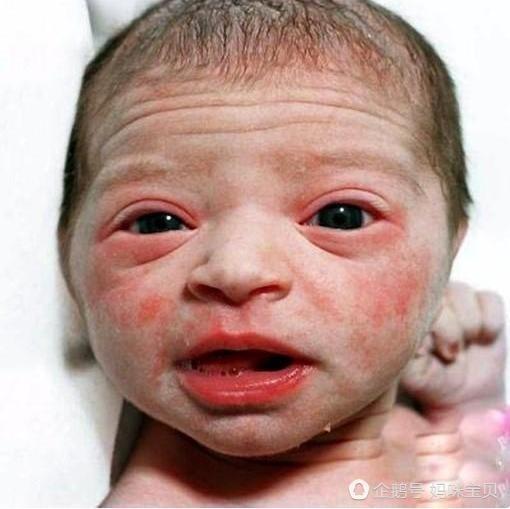 看見剛出生的寶寶，新手媽媽居然被嚇得不知所措