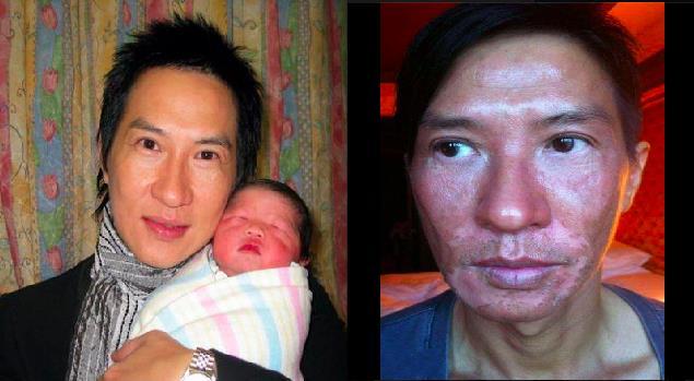 張家輝的臉竟然變成這個樣子，把粉絲們全都嚇壞了！他難過的PO了「這段話」令大家看完都哭了...