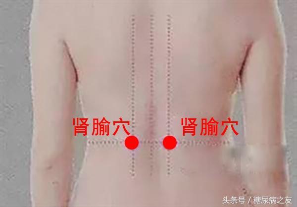 糖尿病中醫按摩保健的6種方法，堅持做，身強體健！