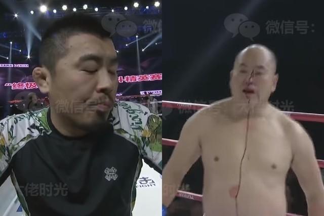 現代武林大賽！武術大師v.s.格鬥狂人...不到30秒「直接見血」結局超悲劇！網笑：這場超虐
