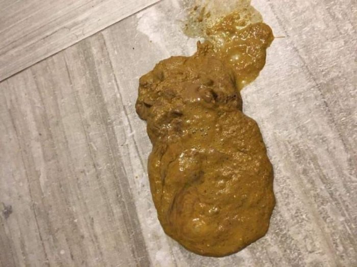 吃飯不要滑手機！他分享自身「慘痛經歷」...往下看到照片網友全笑翻：這文有味道XD