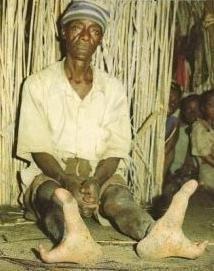 天生只有兩個腳趾!非洲「龍蝦族」鉗子腳掌拿可樂超方便…至今仍在尋找同類(6P+影)