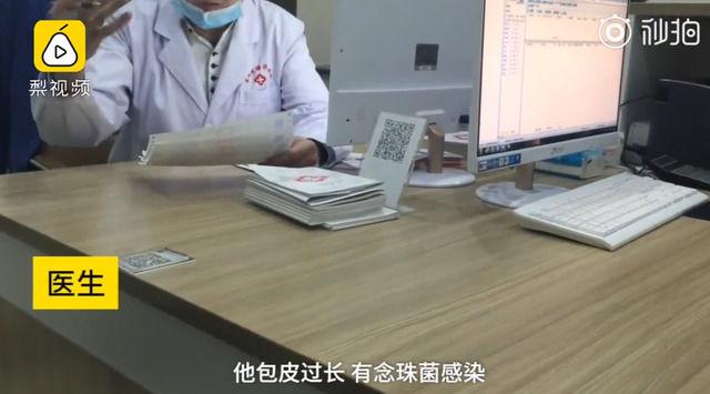 被中國統一為什麼不好？陸男「割包皮到一半被漲價!」..醫生切了爽喊: 漲6倍 (影