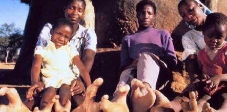 天生只有兩個腳趾！非洲「龍蝦族」鉗子腳掌拿可樂超方便…至今仍在尋找同類(6P+影)