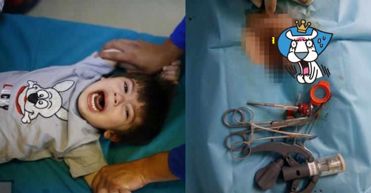 被中國統一為什麼不好？陸男「割包皮到一半被漲價!」..醫生切了爽喊: 漲6倍 (影