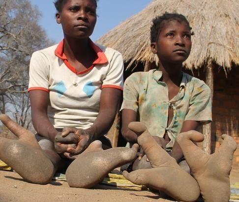 天生只有兩個腳趾!非洲「龍蝦族」鉗子腳掌拿可樂超方便…至今仍在尋找同類(6P+影)