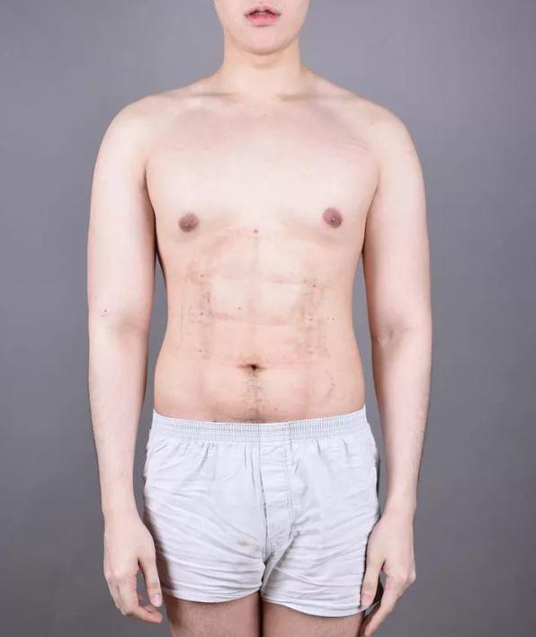 我看了什麼!整形醫院推「六塊肌速成手術」僅2個小時….大驚:弱雞→變猛男!