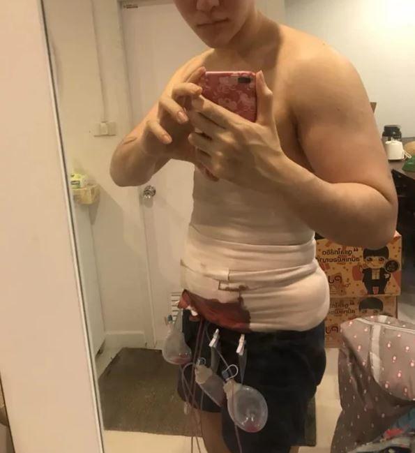 我看了什麼!整形醫院推「六塊肌速成手術」僅2個小時….大驚:弱雞→變猛男!
