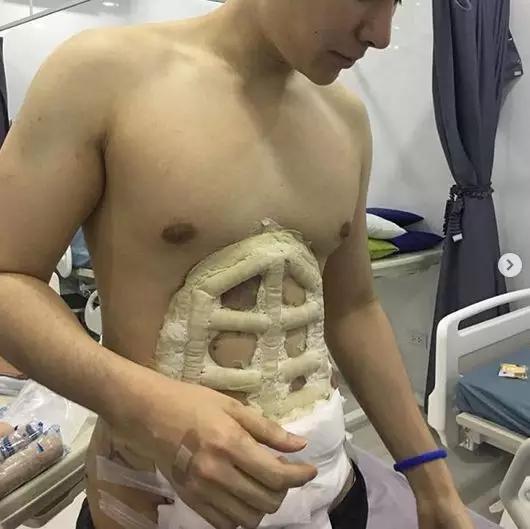 我看了什麼!整形醫院推「六塊肌速成手術」僅2個小時….大驚:弱雞→變猛男!