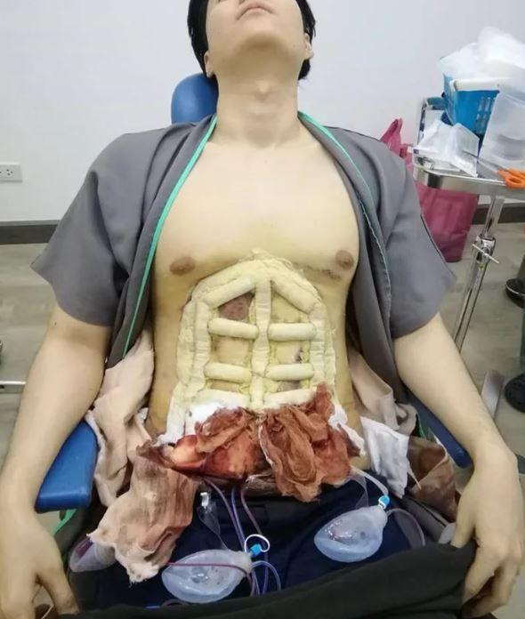 我看了什麼!整形醫院推「六塊肌速成手術」僅2個小時….大驚:弱雞→變猛男!