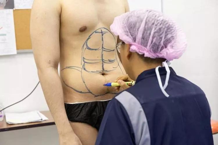 我看了什麼!整形醫院推「六塊肌速成手術」僅2個小時….大驚:弱雞→變猛男!