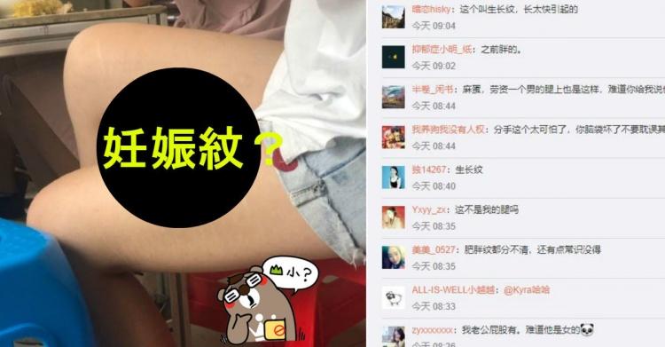 懷疑女友生過… 瞎男PO腿照扯問「有妊娠紋難道？」網眼尖氣狂譙…劇情神反轉：分了吧