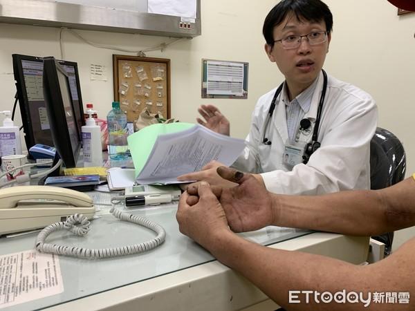 比肺癌更恐怖！抽菸「雙指發黑」慘截肢...醫曝嚴重會切GG