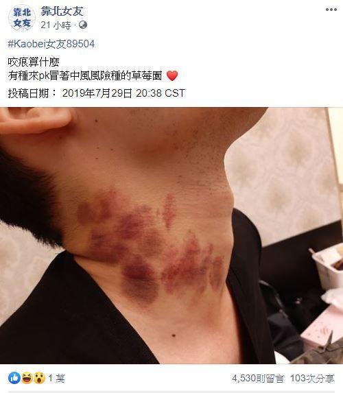 女友需求太大...台男靠北PO網「滿滿愛的痕跡」太驚世嚇人！網看傻：兄弟小心沒命