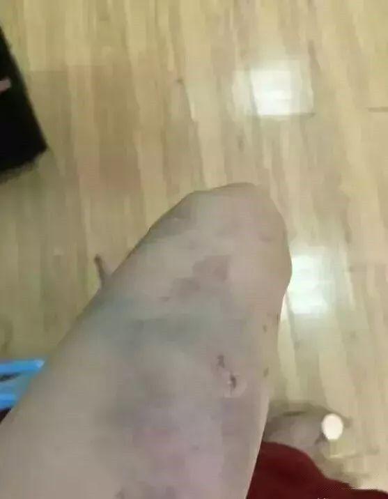 26歲美女老師從14樓跳樓慘死!生前語音曝光「超悲戚輕生原因」網怒:這男根本垃圾