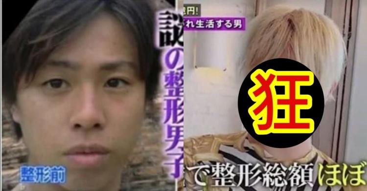 狂砸一億元整形!自卑男靠「六女輪流包養」一年狂整40次!整形後照曝光...網友:好噁!