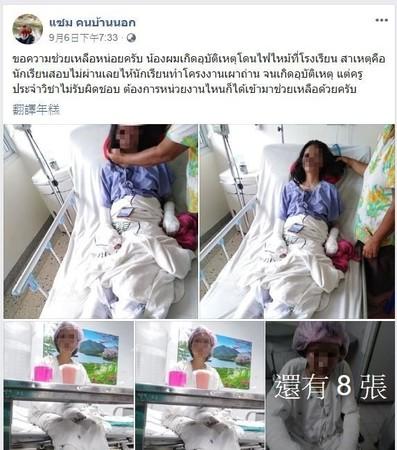 物理不及格!老師給「燒炭」3選擇換成績…高中妹慘燒成重傷