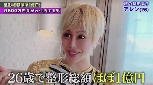 狂砸一億元整形!自卑男靠「六女輪流包養」一年狂整40次!整形後照曝光...網友:好噁!