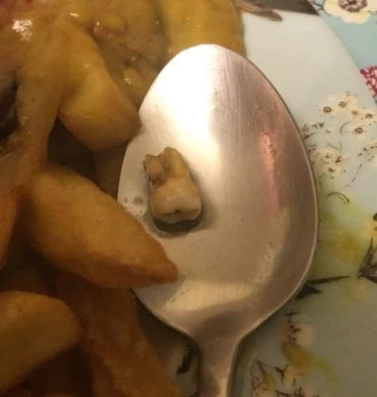 噁吐注意!外送餐點出現「帶血絲的牙齒」店家竟謊稱是豬軟骨...網:黑店公布快筆記
