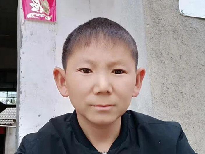 一輩子都是屁孩臉蛋你敢信?六歲時的「悽慘遭遇」…34歲男至今仍童顏:根本不老傳說!