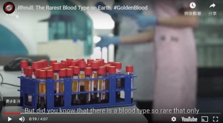 世界超稀有最珍貴的血型！「黃金之血」神秘基因曝光...令人難以置信：新發現！(圖+影