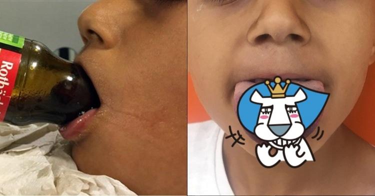 為了一滴果汁都不留!德國男童「舌舔玻璃瓶塞住變這樣」悽慘畫面遭公開...網:恐怖!