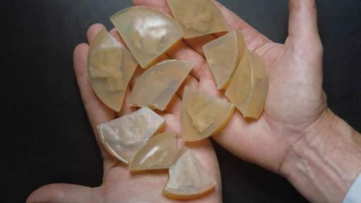 超獵奇的偉人遺體收藏！竟然連拿破侖的GG都有...網傻眼：這些人到底做錯什麼