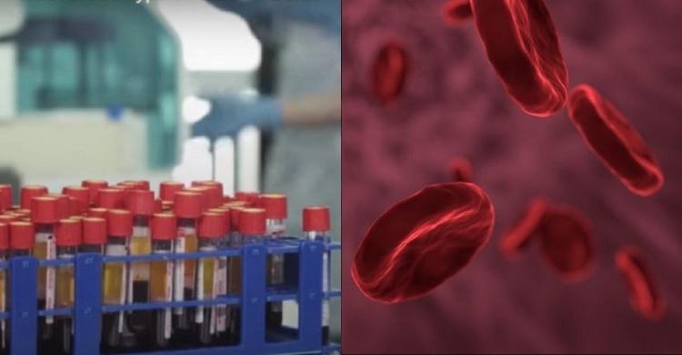 世界超稀有最珍貴的血型！「黃金之血」神秘基因曝光...令人難以置信：新發現！(圖+影