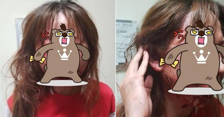 醫生求歡被拒竟爆打長髮女友！「滿臉讓人慘不忍睹」尖叫：完了...我這次死定了！