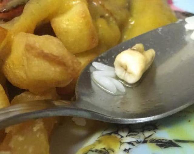 噁吐注意!外送餐點出現「帶血絲的牙齒」店家竟謊稱是豬軟骨...網:黑店公布快筆記
