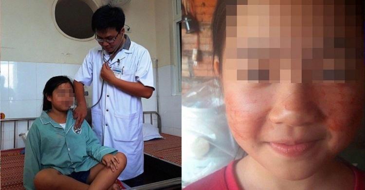 越南11歲女孩竟「每天都要流血3到4次」醫療團隊：「罹患超罕見的疾病」讓人感到不捨！
