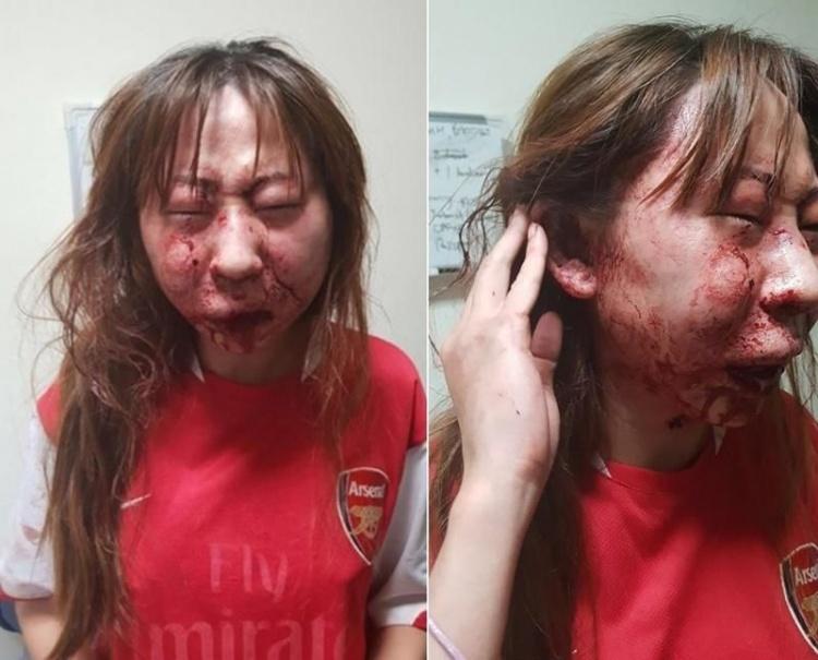 醫生求歡被拒竟爆打長髮女友！「滿臉讓人慘不忍睹」尖叫：完了...我這次死定了！