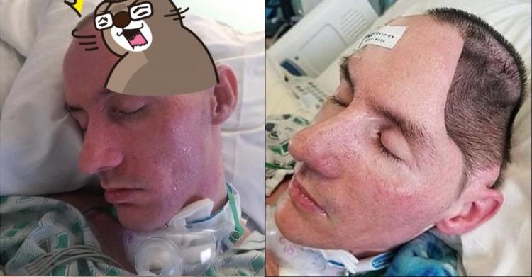 紐約一名男子慘遭球棒痛擊!駭人照曝「左腦殘缺」…惡男:只揮一下拳…72天後出獄!