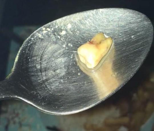 噁吐注意!外送餐點出現「帶血絲的牙齒」店家竟謊稱是豬軟骨...網:黑店公布快筆記