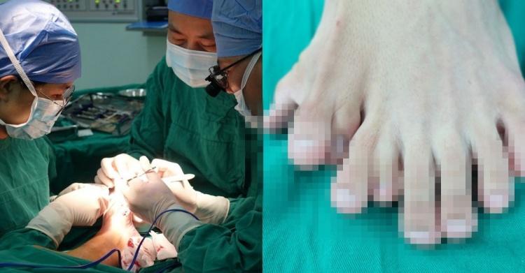 男子患百萬分之一怪病...超驚悚「一隻腳長九根腳趾頭」鞋子也穿不下...網嚇歪:好可怕!