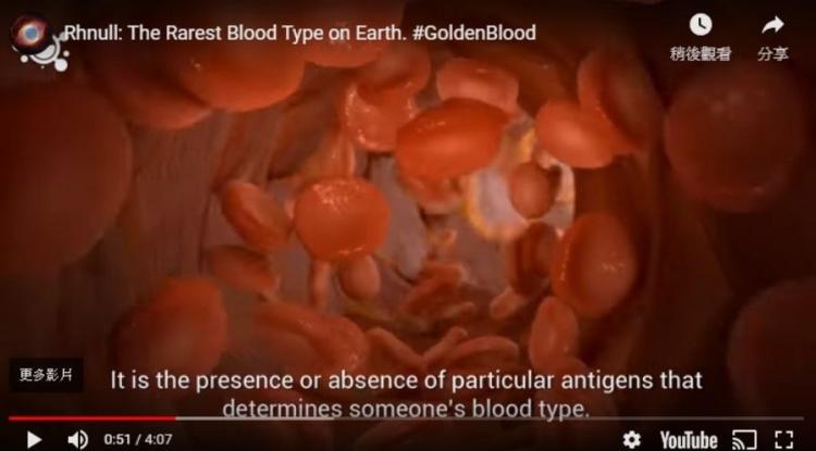 世界超稀有最珍貴的血型！「黃金之血」神秘基因曝光...令人難以置信：新發現！(圖+影