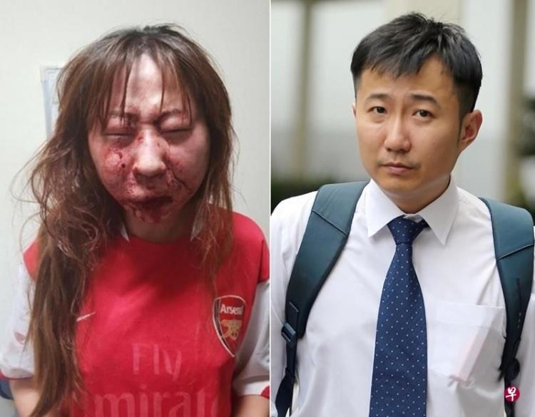 醫生求歡被拒竟爆打長髮女友！「滿臉讓人慘不忍睹」尖叫：完了...我這次死定了！