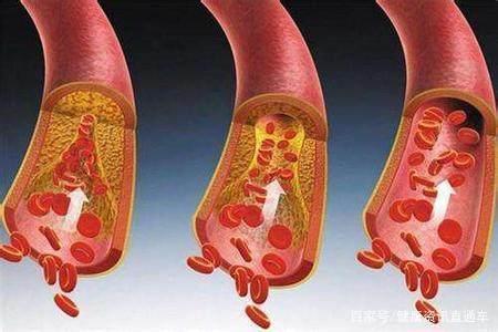 100歲的老人，擁有30歲的血管和心髒！因為每天喝了三杯這個！