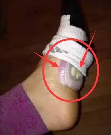 婆婆睡覺前把「洋蔥」放進襪子裡！7天後，身體有了奇妙的變化