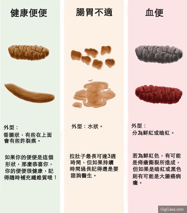 上廁所屁股痛不一定是痔瘡！在英國每15分鐘就有一個人被診斷出「大腸癌」...如果你符合「這些症狀」再不趕快去