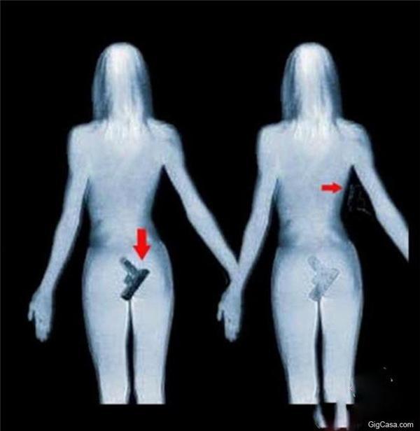 正妹經過海關時遭到X光透視，卻被屁股後方正插著「這東西」！ 當場嚇壞海關人員！