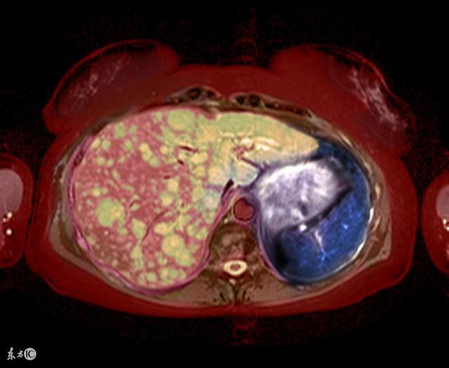 中醫坦白:肝不好的人,這3個部位會發黑!秋季多吃3種改善肝功能的食物!