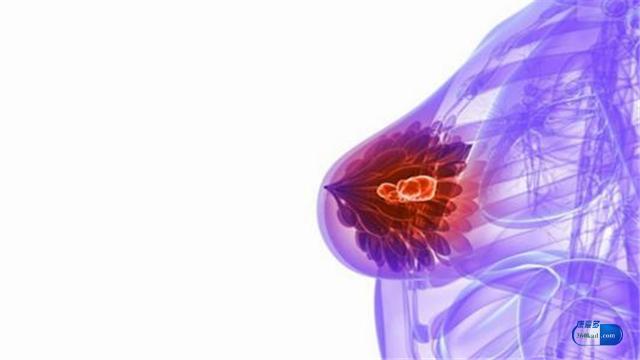 乳腺癌來襲前,會有5個信號提示你!現在知道還未晚