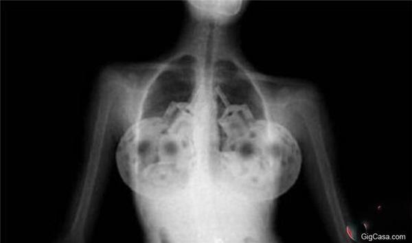 正妹經過海關時遭到X光透視，卻被屁股後方正插著「這東西」！ 當場嚇壞海關人員！