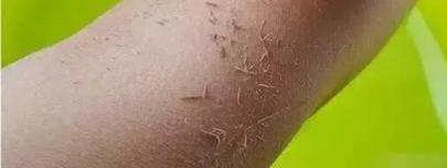 洗澡的時候從你身上搓出來的「泥」到底是什麼?「真相」嚇人一大跳!