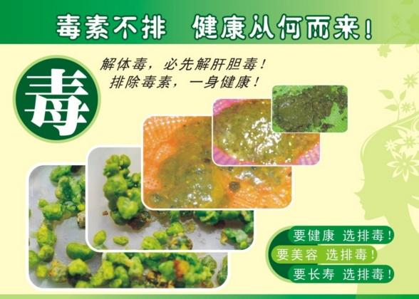 你的體內有十幾斤宿便，這是真的嗎？ 